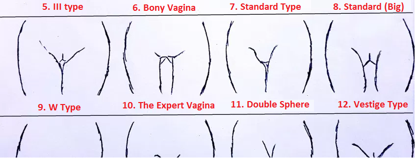 different types vagina Different of