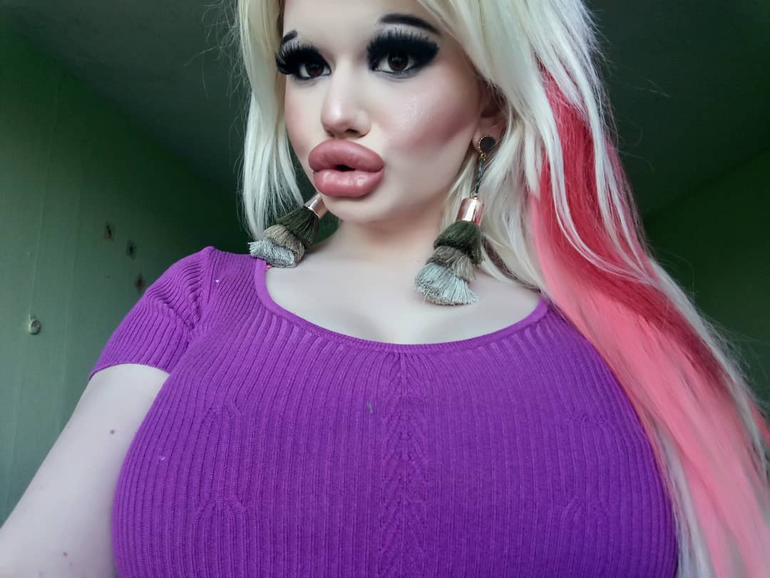 This Woman Goes Through 15 Surgeries In A Year To Look Like Barbie