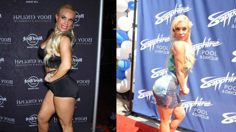 celebrities got plastic surgeries