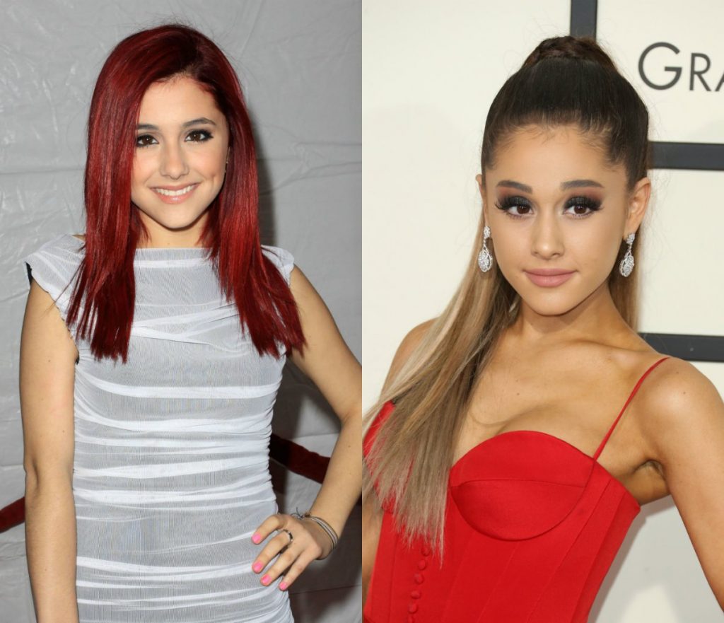 Surgery plastic ariana grande Who is